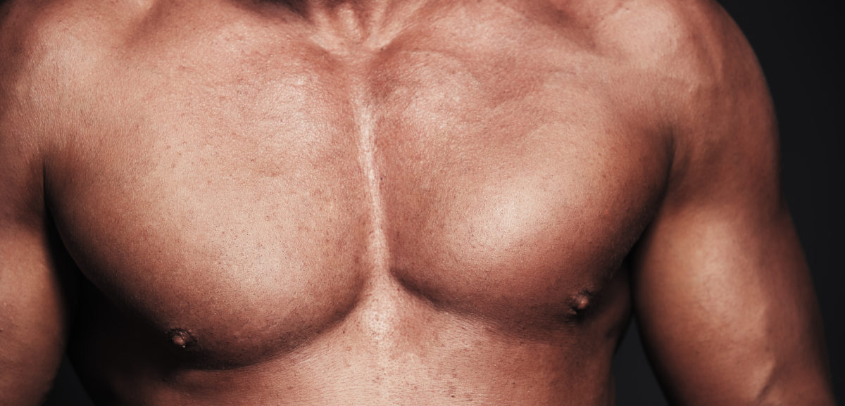 Gynecomastia Bay Area