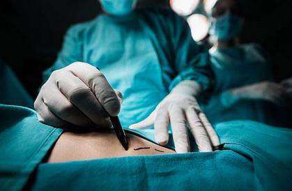 Plastic Surgeon Walnut Creek