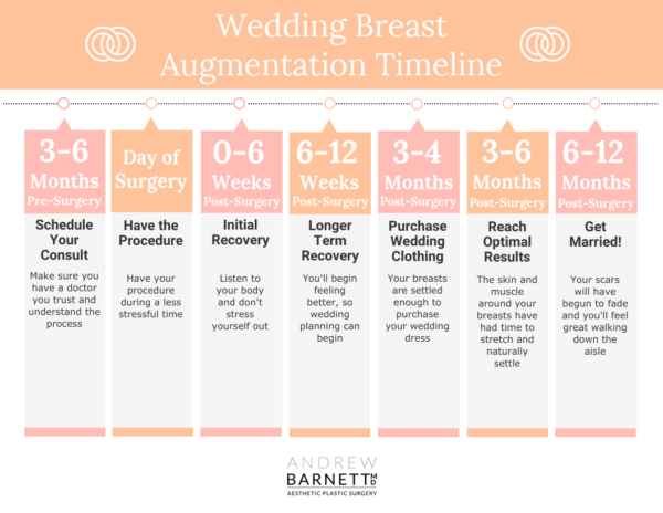 Wedding Breast Augmentation Timeline Walnut Creek Wedding Breast Augmentation Timeline Walnut Creek