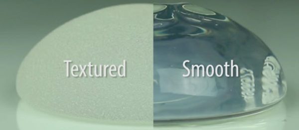 implant-shell breast implant shell