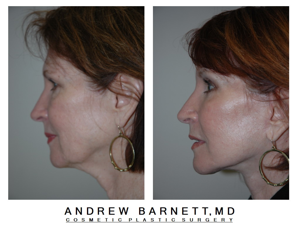 Patient002 — Profile View